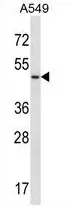 GPR14 (UTS2R) (Center) Rabbit Polyclonal Antibody - image 1