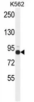 ZNF366 (C-term) Rabbit Polyclonal Antibody - image 1