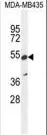 ZNF98 (C-term) Rabbit Polyclonal Antibody - image 1