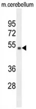 WDR41 (C-term) Rabbit Polyclonal Antibody - image 1