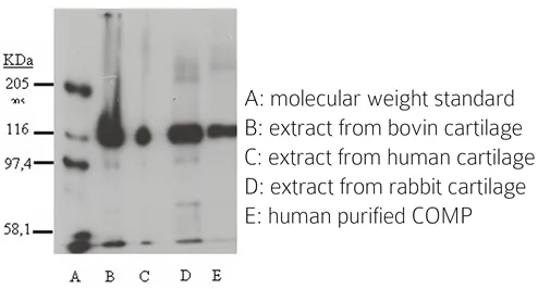 COMP Rabbit Polyclonal Antibody - image 1