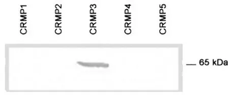 CRMP3 (DPYSL4) Rabbit Polyclonal Antibody - image 1