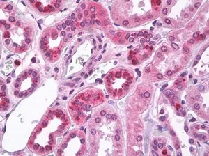MBD2 Rabbit Polyclonal Antibody - image 1