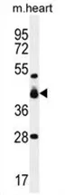 VSIG8 (C1orf204) (C-term) Rabbit Polyclonal Antibody - image 1