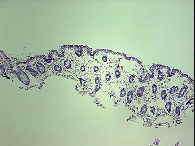 Frozen Tissue Blocks, Colon: right - image 1