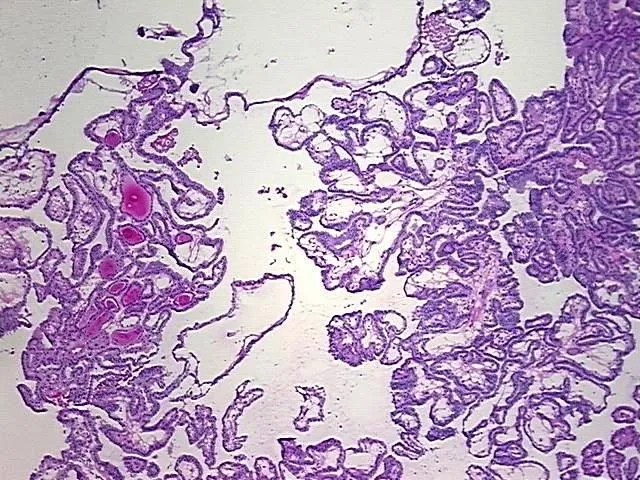 Frozen Tissue Blocks, Thyroid gland - image 1