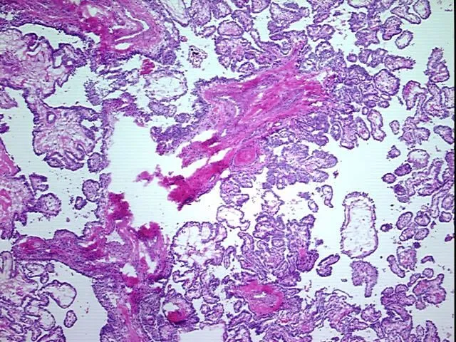 Frozen Tissue Blocks, Thyroid gland - image 1