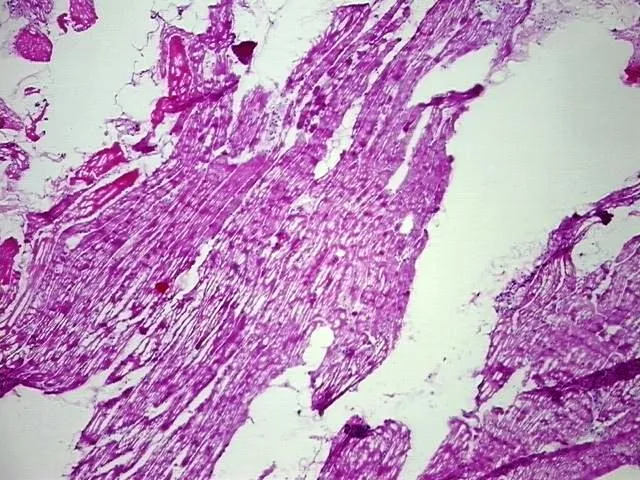Frozen Tissue Blocks, Muscle tissue - image 1
