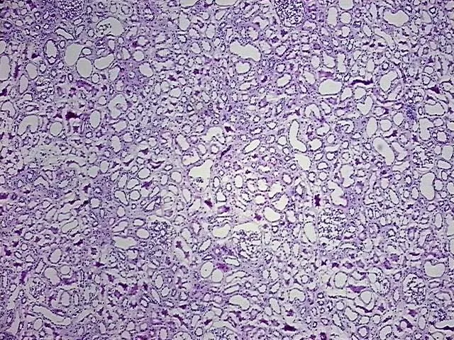 Frozen Tissue Blocks, Kidney - image 1