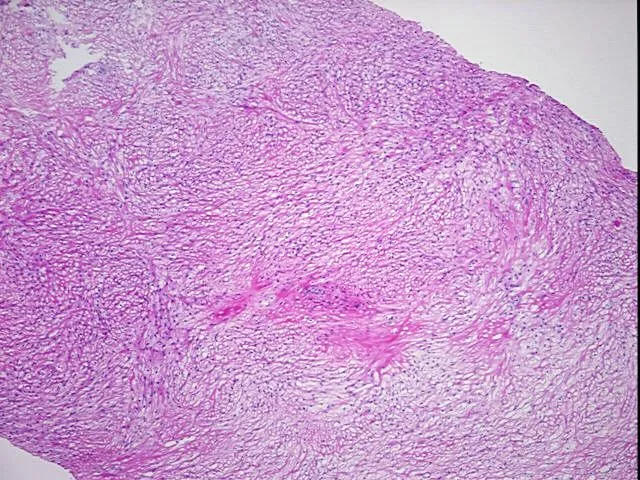 Frozen Tissue Blocks, Ovary - image 1
