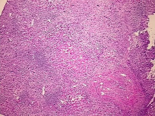 Frozen Tissue Blocks, Liver - image 1