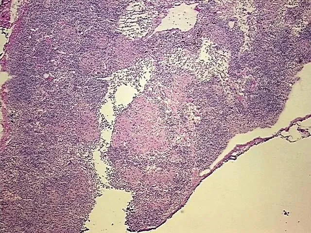 Frozen Tissue Blocks, Lymph node - image 1