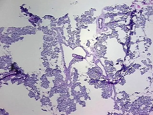 Frozen Tissue Blocks, Parotid gland - image 1