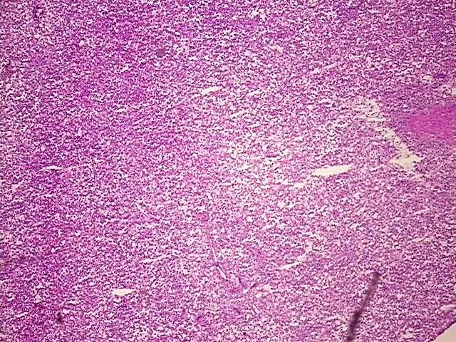 Frozen Tissue Blocks, Lymphoid tissue - image 1