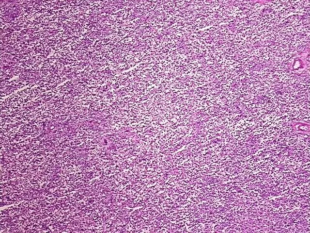 Frozen Tissue Blocks, Lymphoid tissue - image 1
