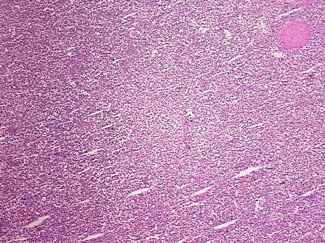 Frozen Tissue Blocks, Lymphoid tissue - image 1