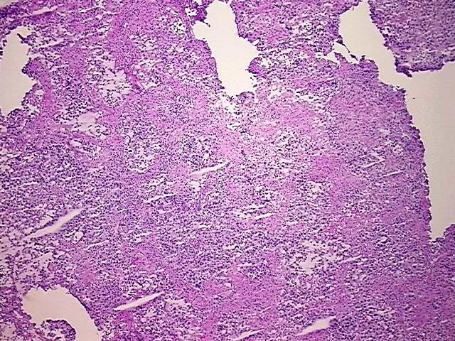 Frozen Tissue Blocks, Testis - image 1