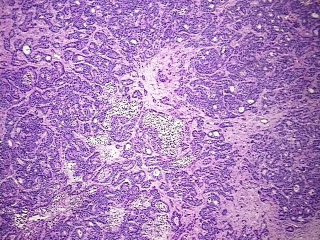Frozen Tissue Blocks, Colon - image 1