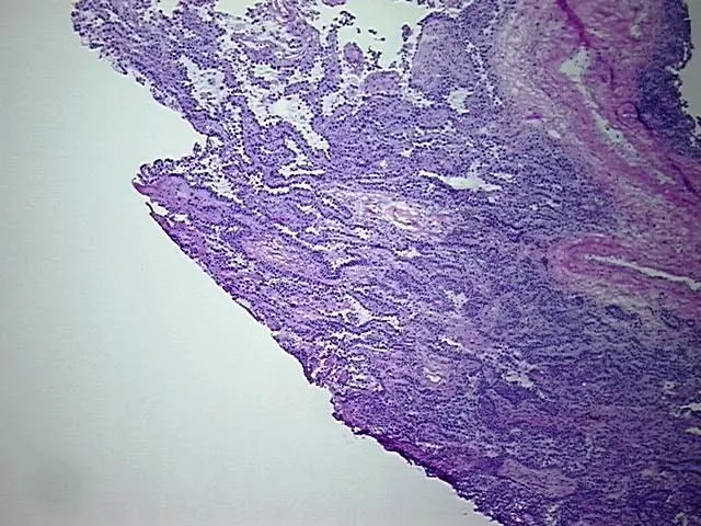 Frozen Tissue Blocks, Lung - image 1