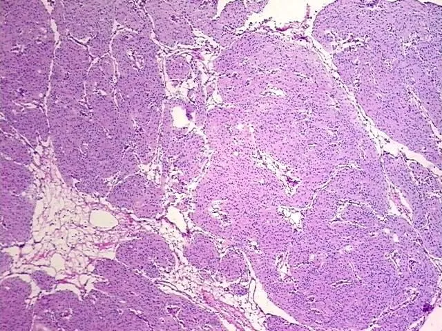 Frozen Tissue Blocks, Brain - image 1