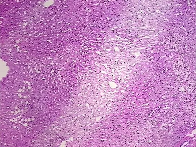 Frozen Tissue Blocks, Liver: left lobe - image 1