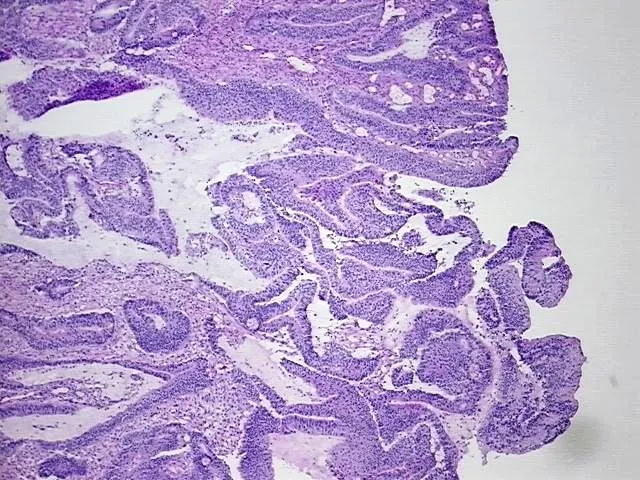Frozen Tissue Blocks, Cecum - image 1