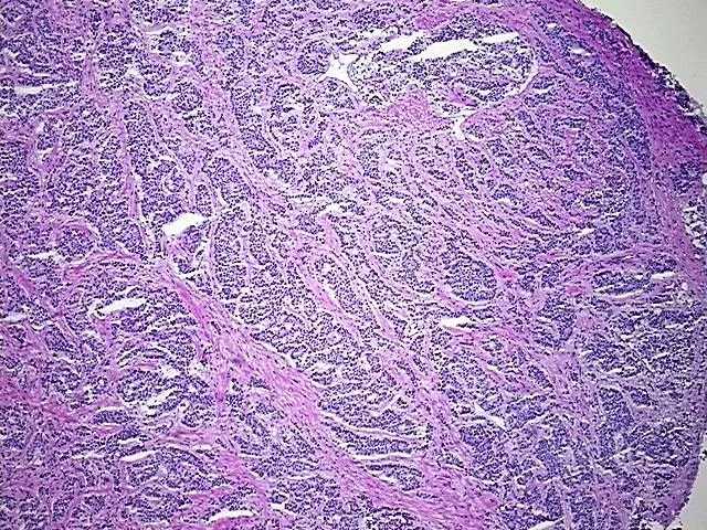 Frozen Tissue Blocks, Ileum - image 1