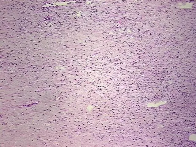 Frozen Tissue Blocks, Soft tissue - image 1