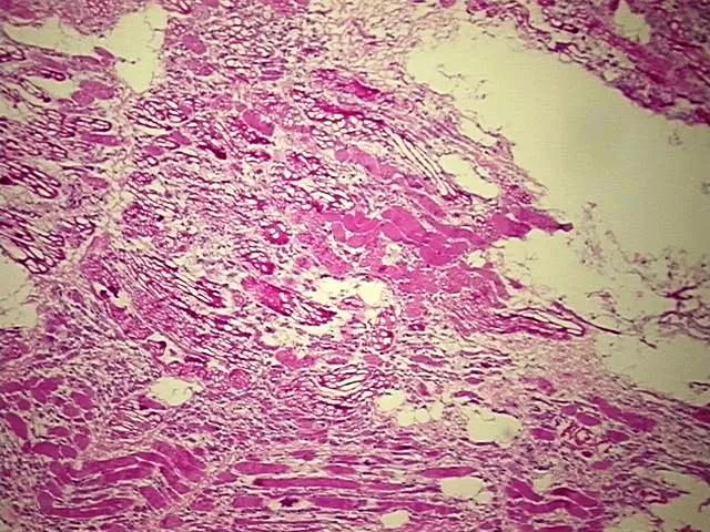 Frozen Tissue Blocks, Muscle tissue - image 1