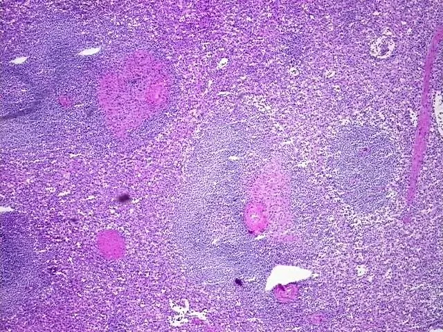 Frozen Tissue Blocks, Spleen - image 1