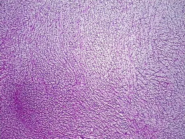 Frozen Tissue Blocks, Ovary: right - image 1