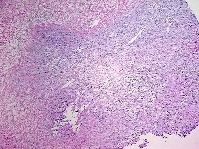 Frozen Tissue Blocks, Skin - image 1
