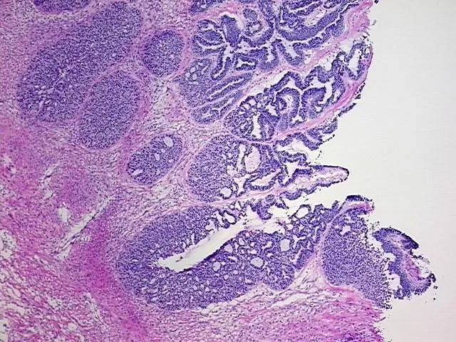 Frozen Tissue Blocks, Ovary: left - image 1