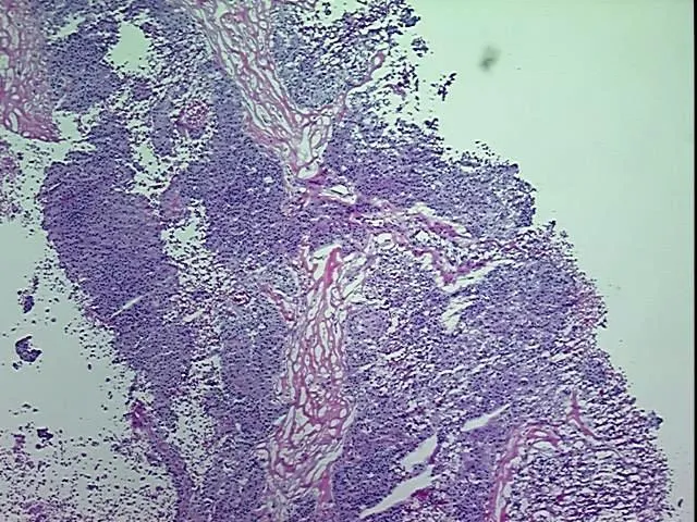 Frozen Tissue Blocks, Ovary - image 1