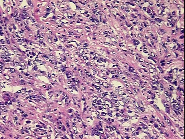Frozen Tissue Blocks, Skin - image 1