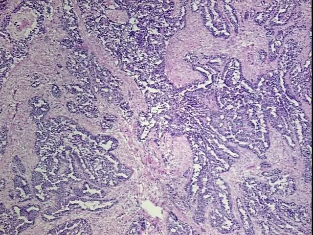 Frozen Tissue Blocks, Ovary - image 1