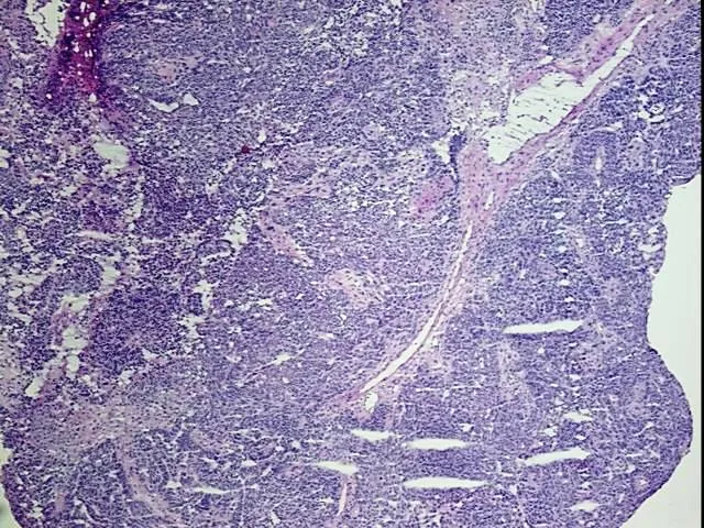 Frozen Tissue Blocks, Ovary - image 1