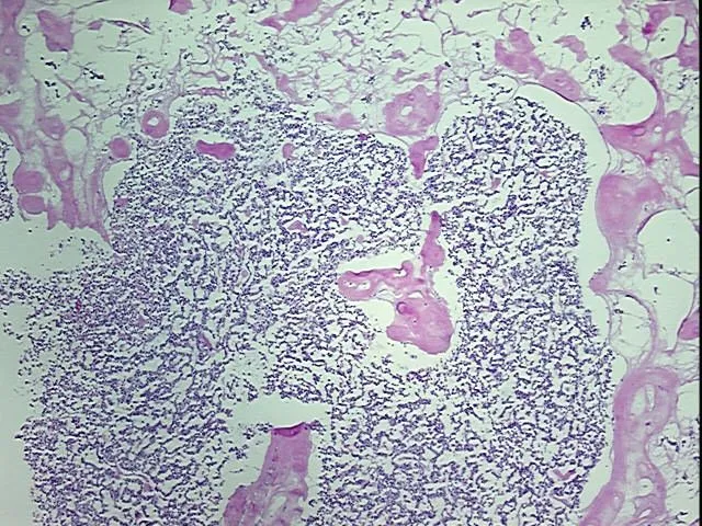 Frozen Tissue Blocks, Pancreas - image 1