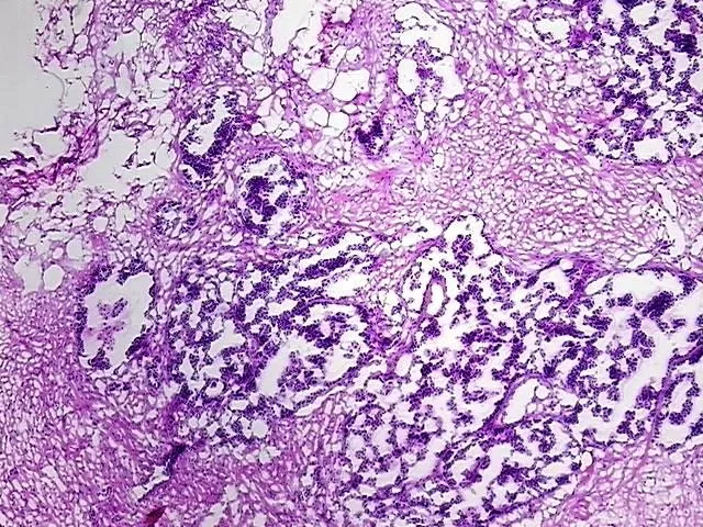 Frozen Tissue Blocks, Ovary - image 1