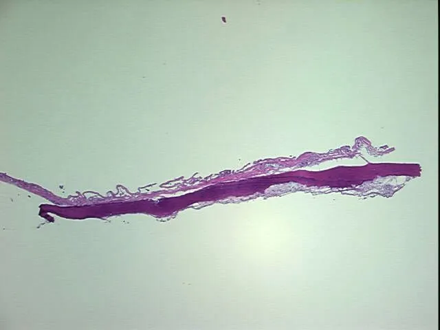 Frozen Tissue Blocks, Nose - image 1