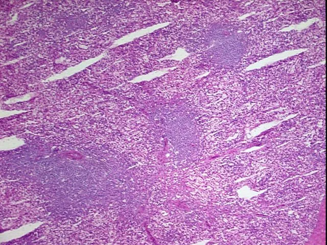 Frozen Tissue Blocks, Lymphoid tissue - image 1