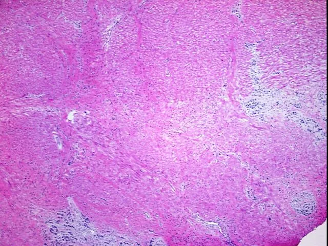 Frozen Tissue Blocks, Stomach - image 1