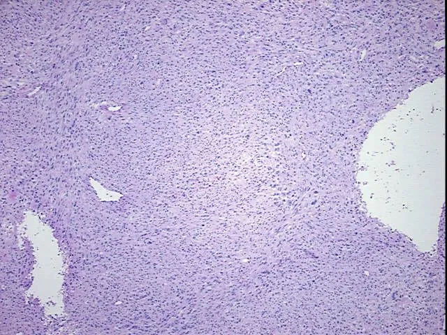Frozen Tissue Blocks, Uterus - image 1
