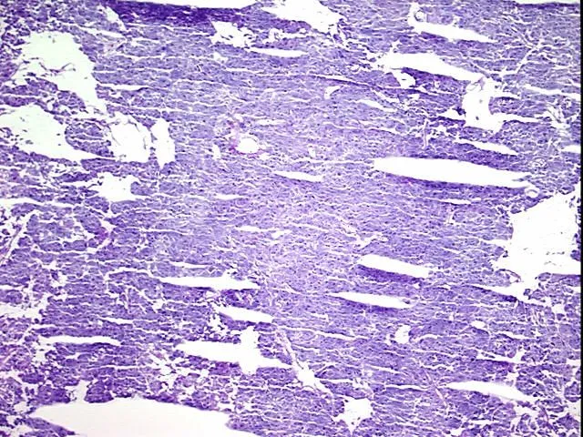 Frozen Tissue Blocks, Adrenal gland - image 1