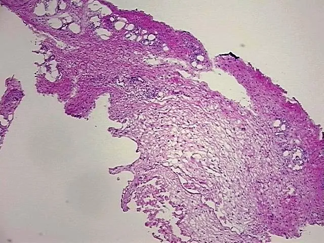 Frozen Tissue Blocks, Joint - image 1