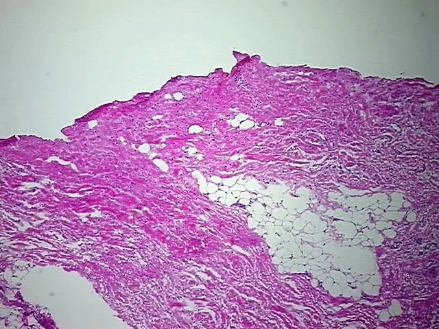 Frozen Tissue Blocks, Soft tissue - image 1