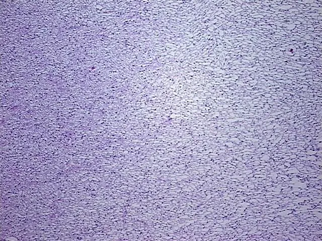 Frozen Tissue Blocks, Brain - image 1