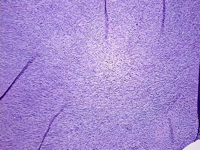 FFPE Tissue Blocks, Soft tissue - image 1