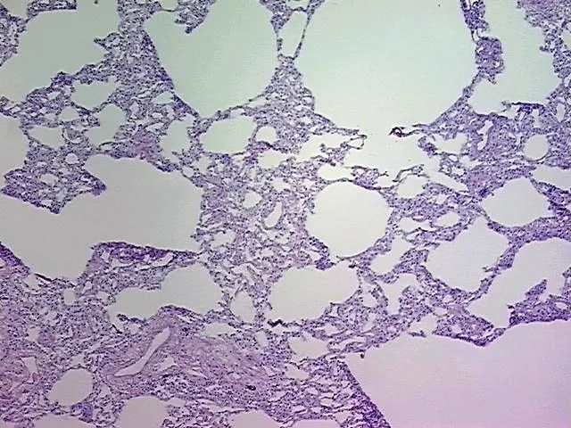 Tissue Genomic DNA, Lung - image 1