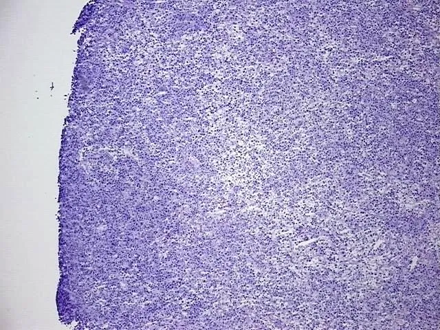 Tissue Genomic DNA, Lymphoid tissue - image 1